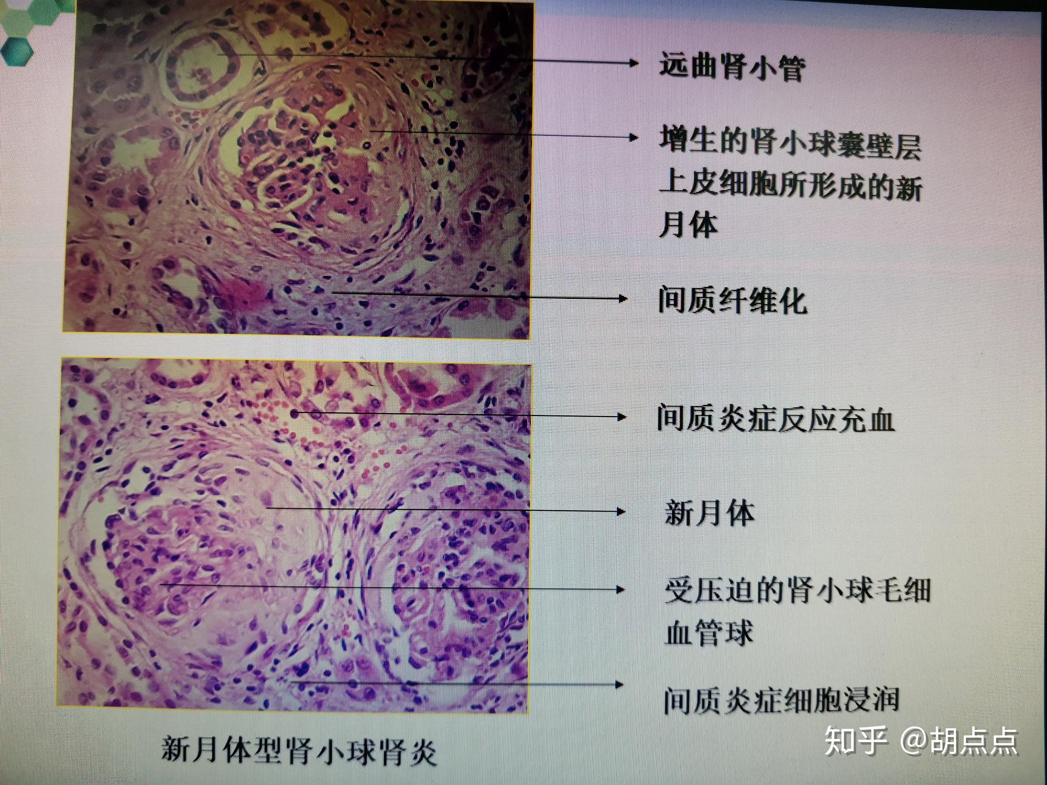 正常肾组织切片图解图片