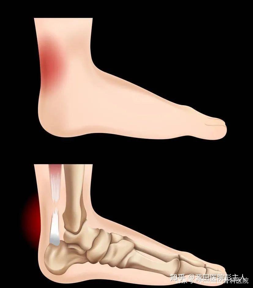 什么是正骨推拿 v2-48b761e645f2cb6eb82ebff1333272de_r.jpg