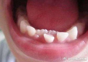 v2-490d7cb1e12fff3e14bc52e61d040bae_1440w.jpg?source=172ae18b