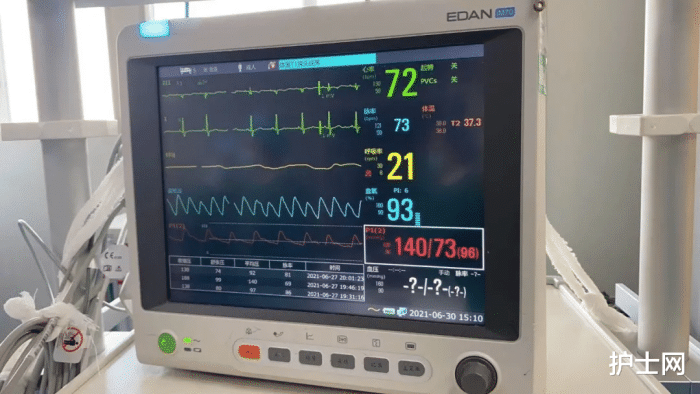 有创动脉血压监测图片