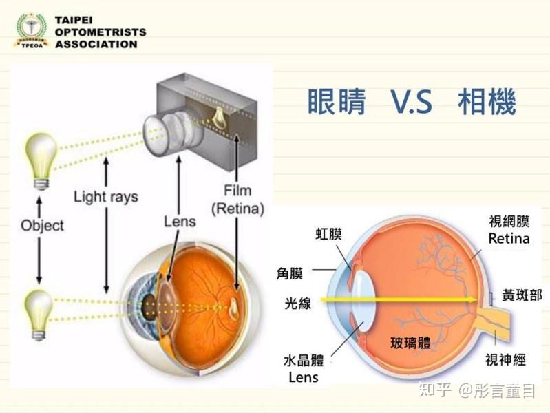 你瞭解眼睛的光學結構跟屈光不正嗎近視遠視散光