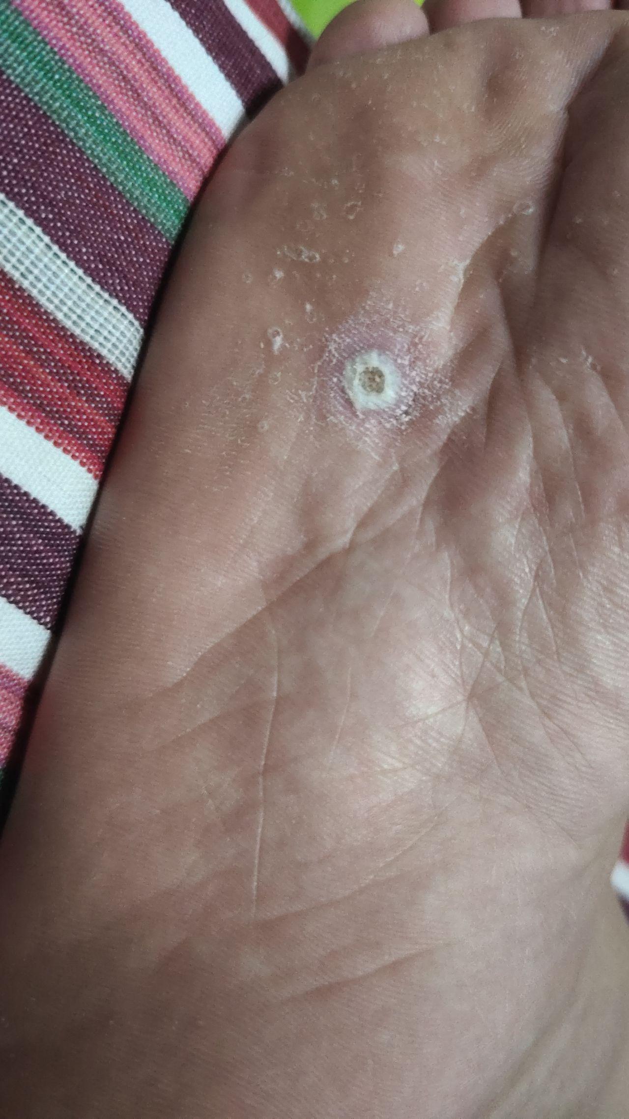 4月1日,剪的有点过头儿了,血都出来了 疼.