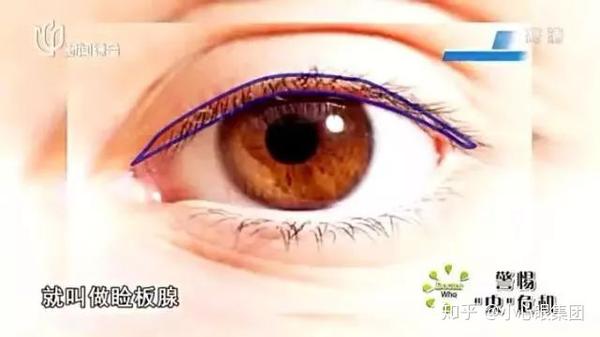 震惊 眼睛干涩要当心 可能是螨虫在作怪 严重还会导致干眼症 知乎 震惊 眼睛干涩要当心 可能是螨虫在作怪 严重还会导致干眼症 知乎