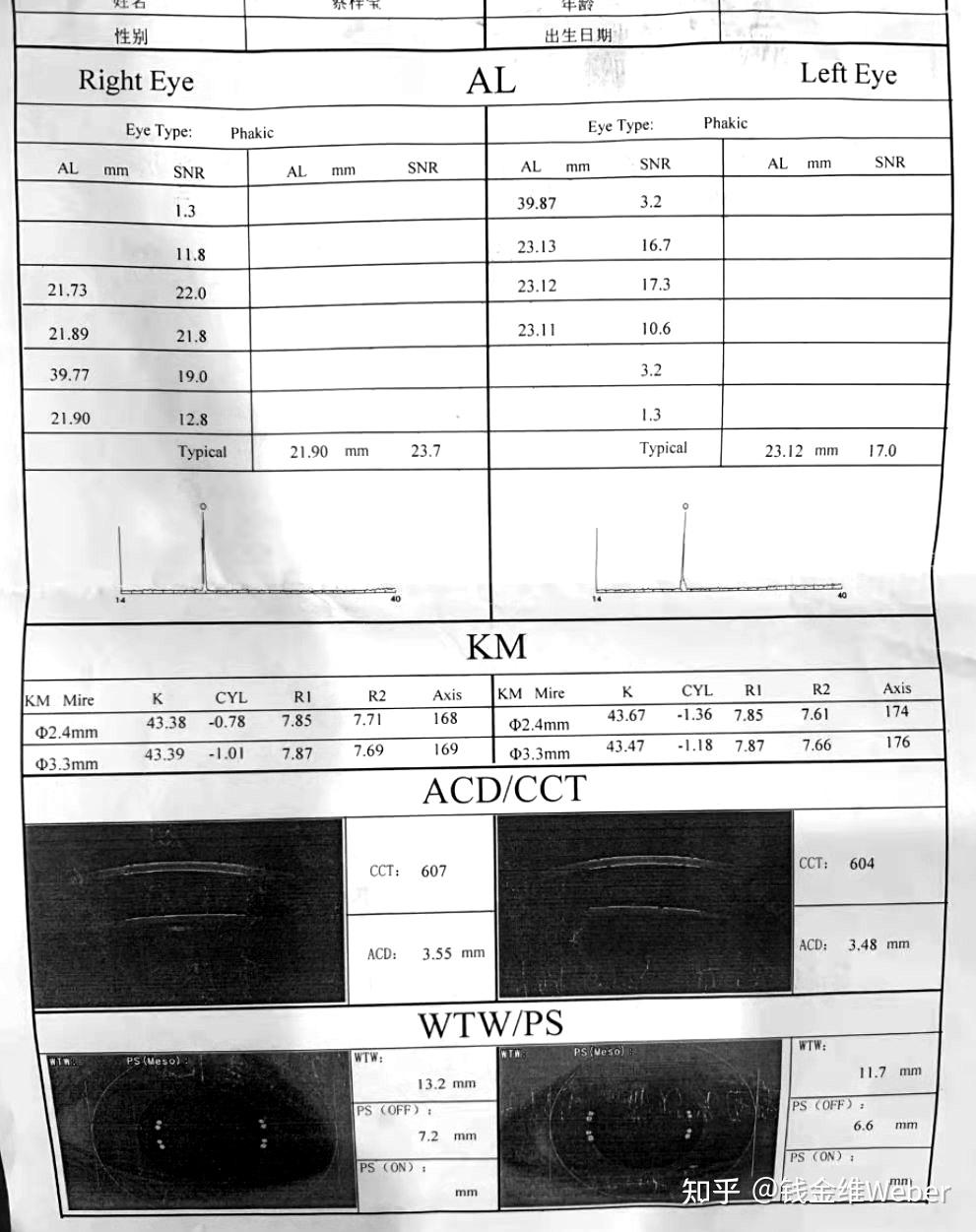 下面这个是家长发过来的眼球生物测量仪检查报告单:慢散,瞳孔直径6.