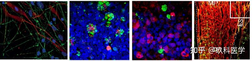 技巧分享 | 免疫荧光实验原来还有那么多细节 - 知乎