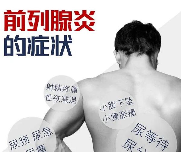 治疗男性前列腺炎的新途径——干细胞 - 知乎