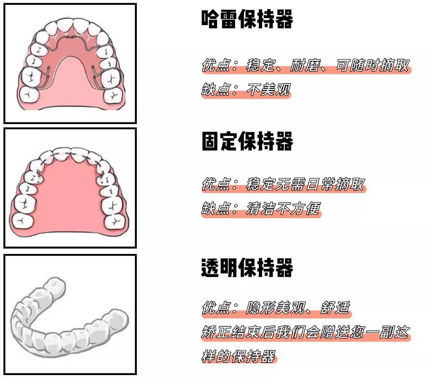 目前临床常见的保持器有:hawley哈雷保持器,压膜式透明保持器,固定式