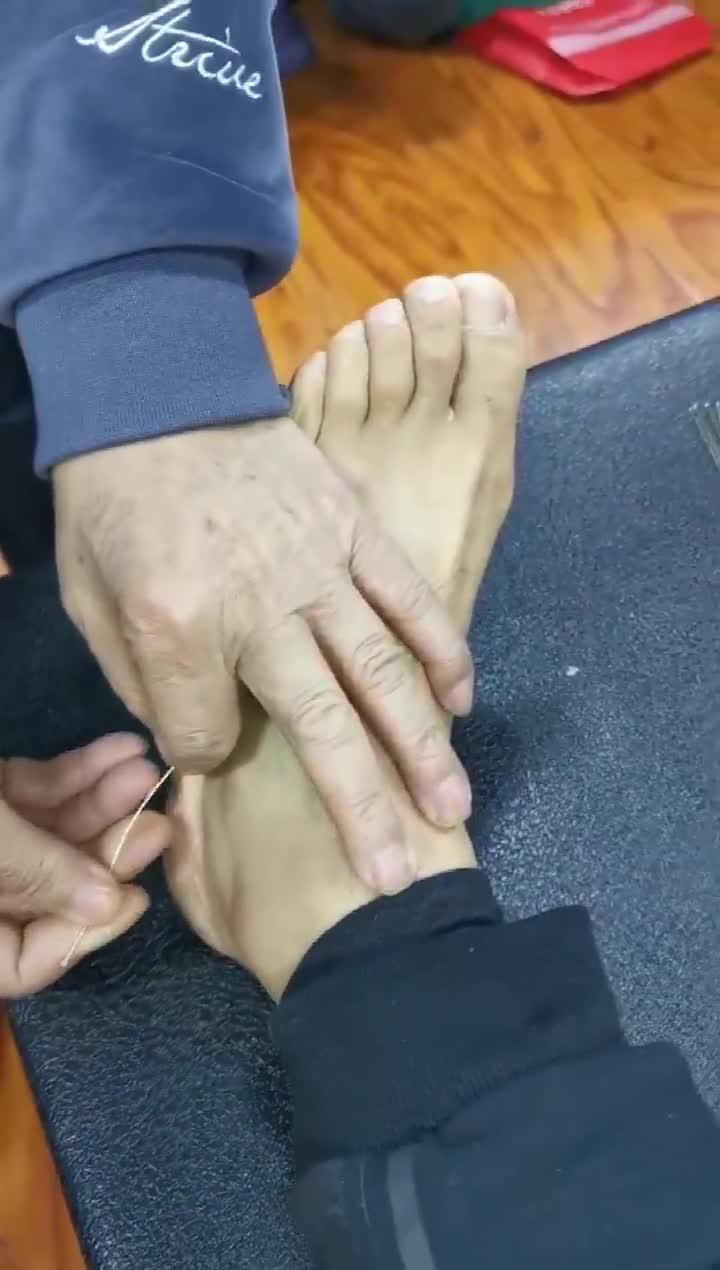 李茂发针灸治疗全集(李茂发针灸治疗最新视频)