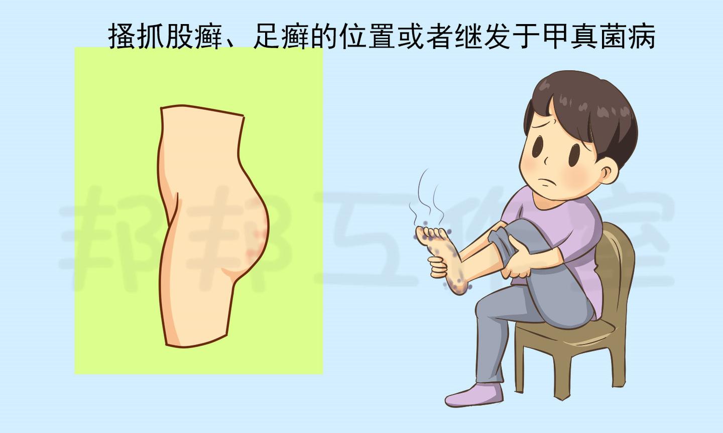 手是人的第二张脸,有哪些常见的手部皮肤病 - 知乎