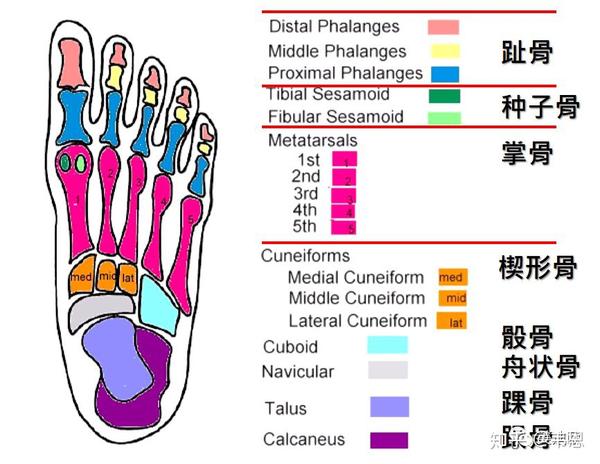 先天性跗骨黏合或附生舟狀骨