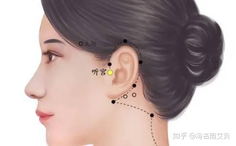 打通三穴,防治耳聋耳鸣 - 知乎