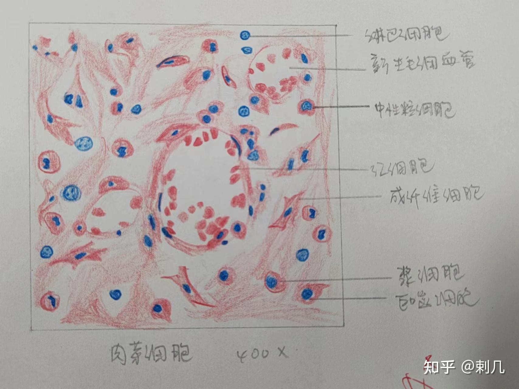 肉芽组织手绘图图片