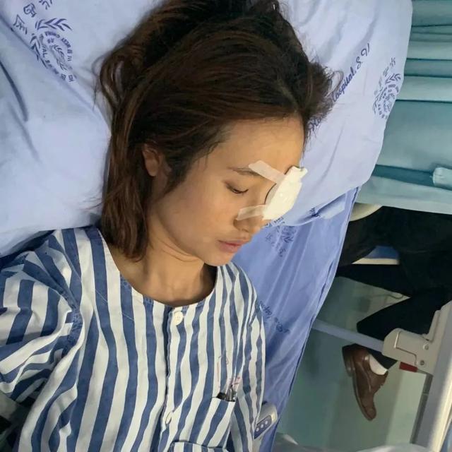 星医百一周告别高度近视真人记录眼部近视矫正治疗过程