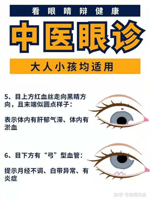 中医眼诊简易学习 - 知乎