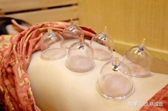 最早的拔罐一般是用竹筒,后来用陶罐,瓷瓶,甚至铁罐,十多二十年前玻璃