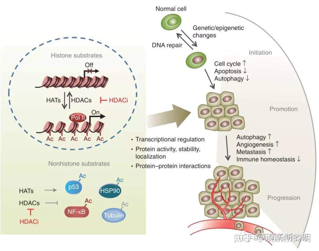 肿瘤表观遗传第三讲组蛋白乙酰化