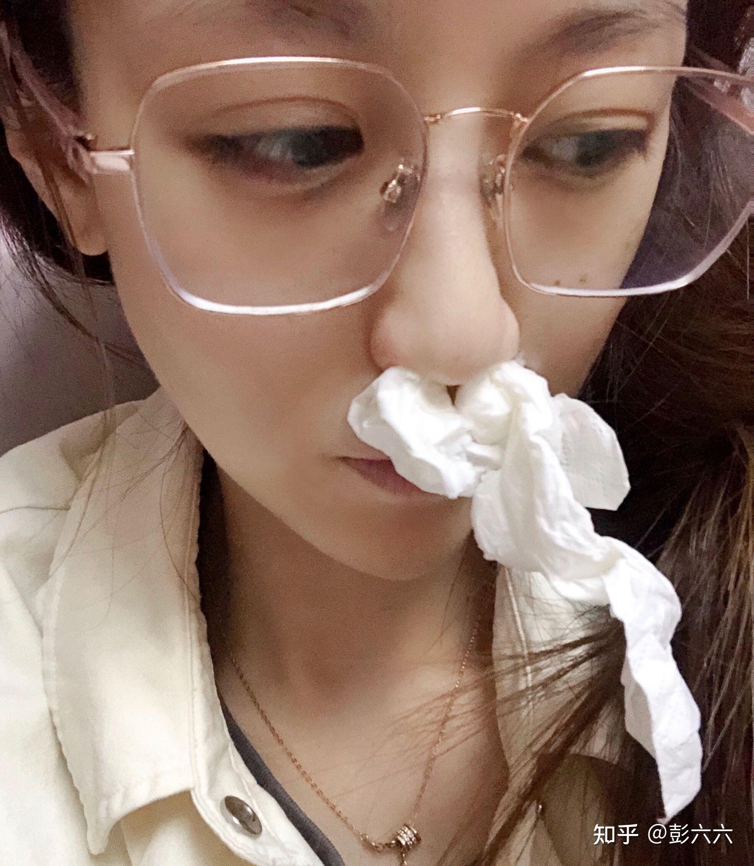 过敏性鼻炎能治好吗治过敏性鼻炎的药