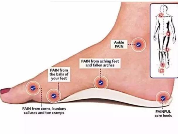扁平足的疼痛位置