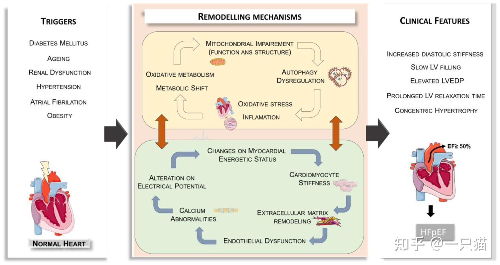 目前为止研究射血分数保留型心力衰竭所了解的病理生理机制只是冰山一