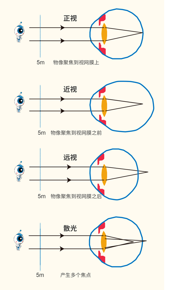 3 -