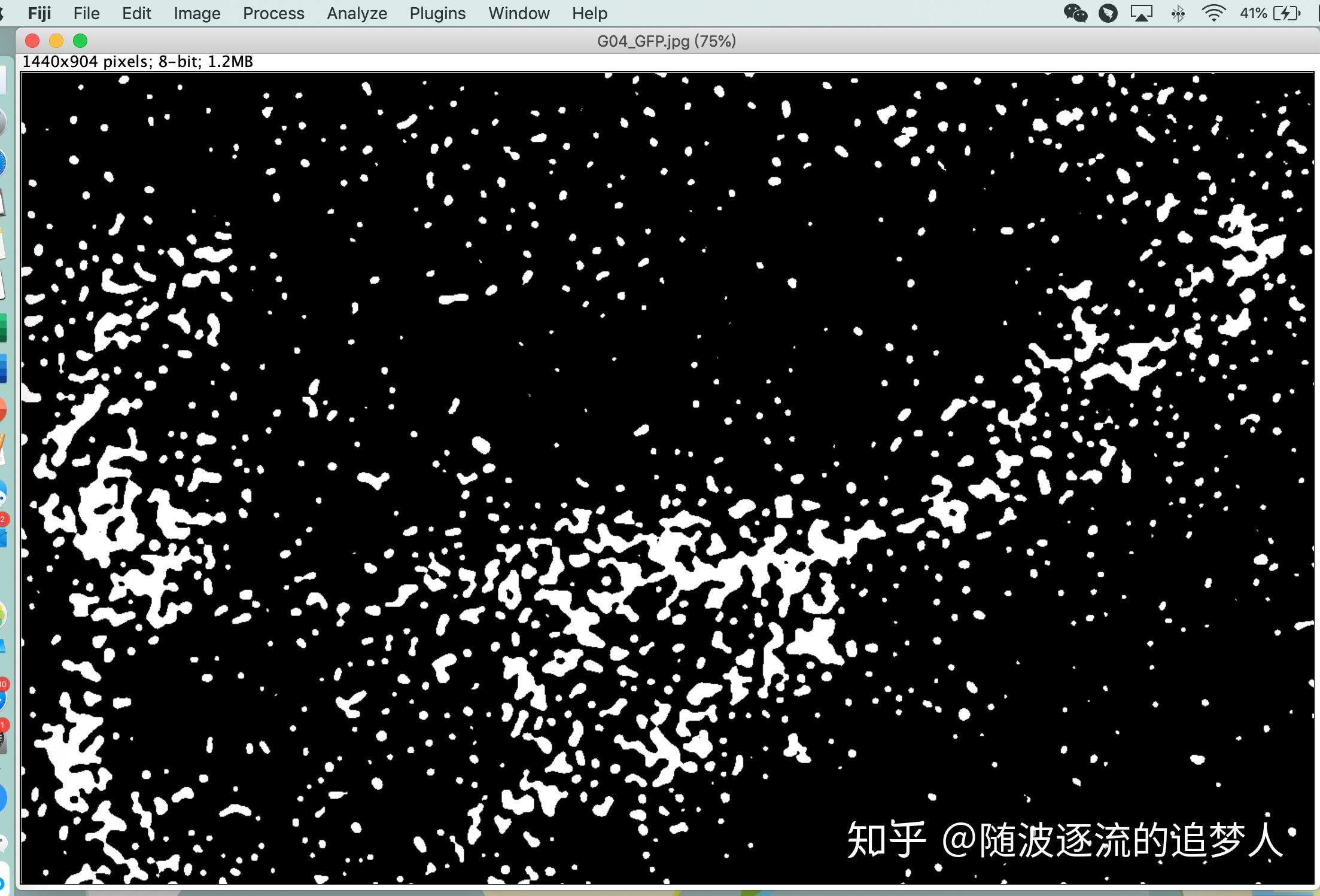 如何用image j做免疫熒光細胞計數分析(mac版本) - 知乎