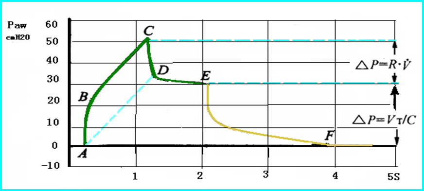 呼吸机常见波形