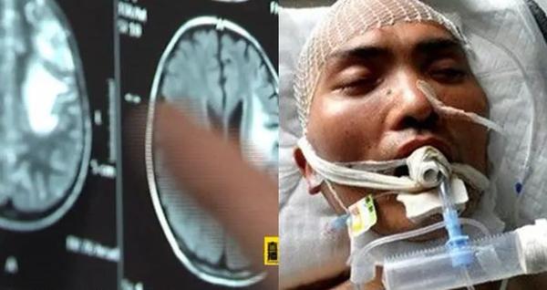 感染这种生活中常见的食脑虫你可能必死无疑