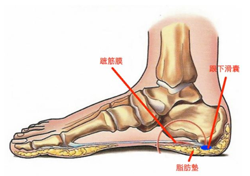 常见的足底或足跟疼痛除了足底筋膜炎外