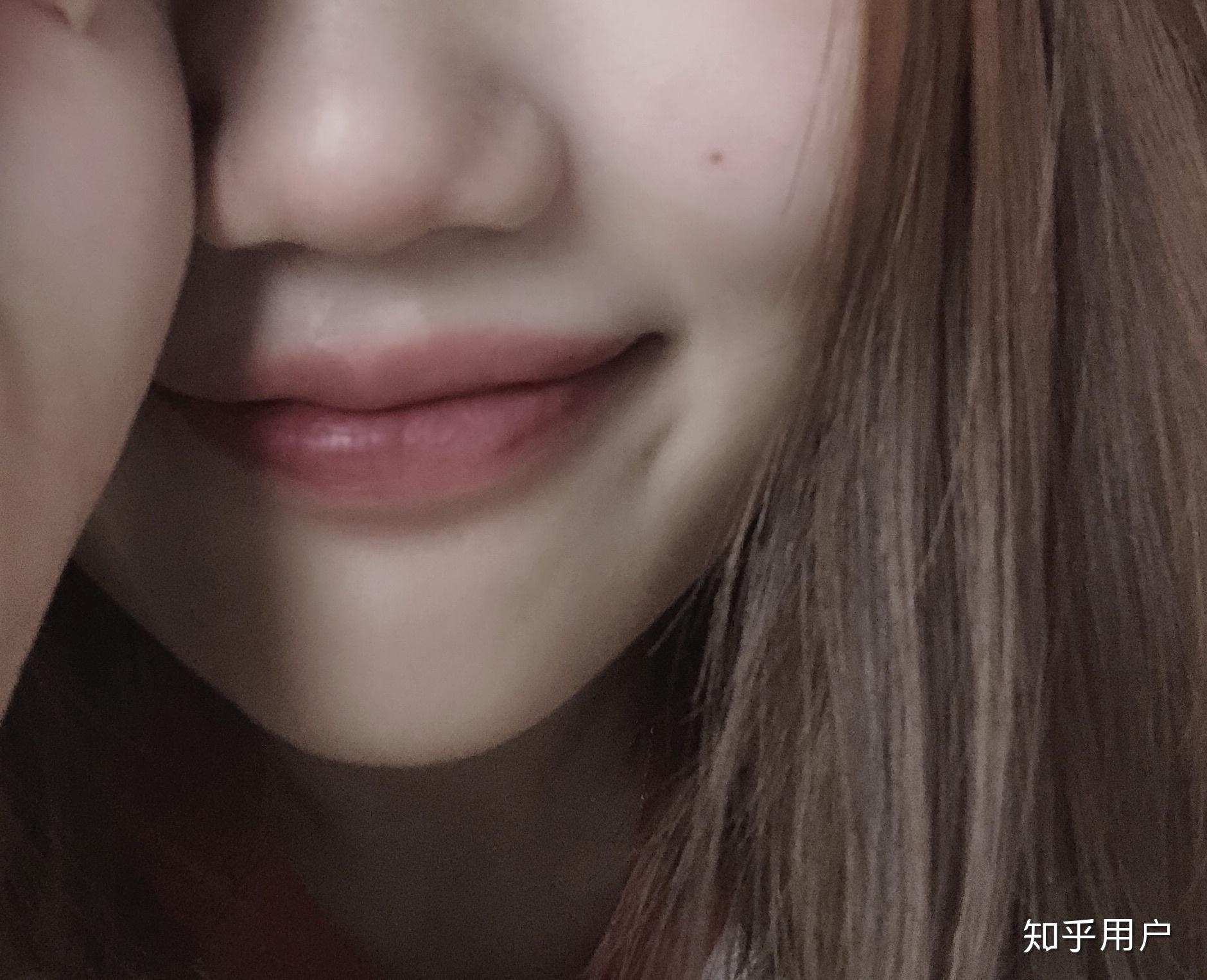 嘴角下有个窝不是梨涡是什么