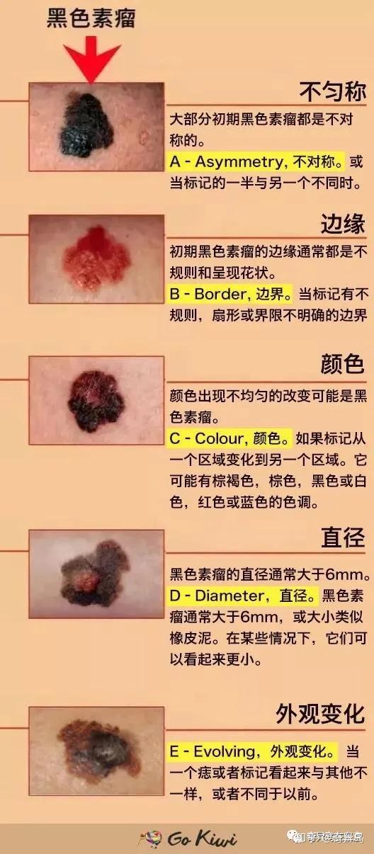 尤物必备的面部硬件竟然会致命日本整形整容