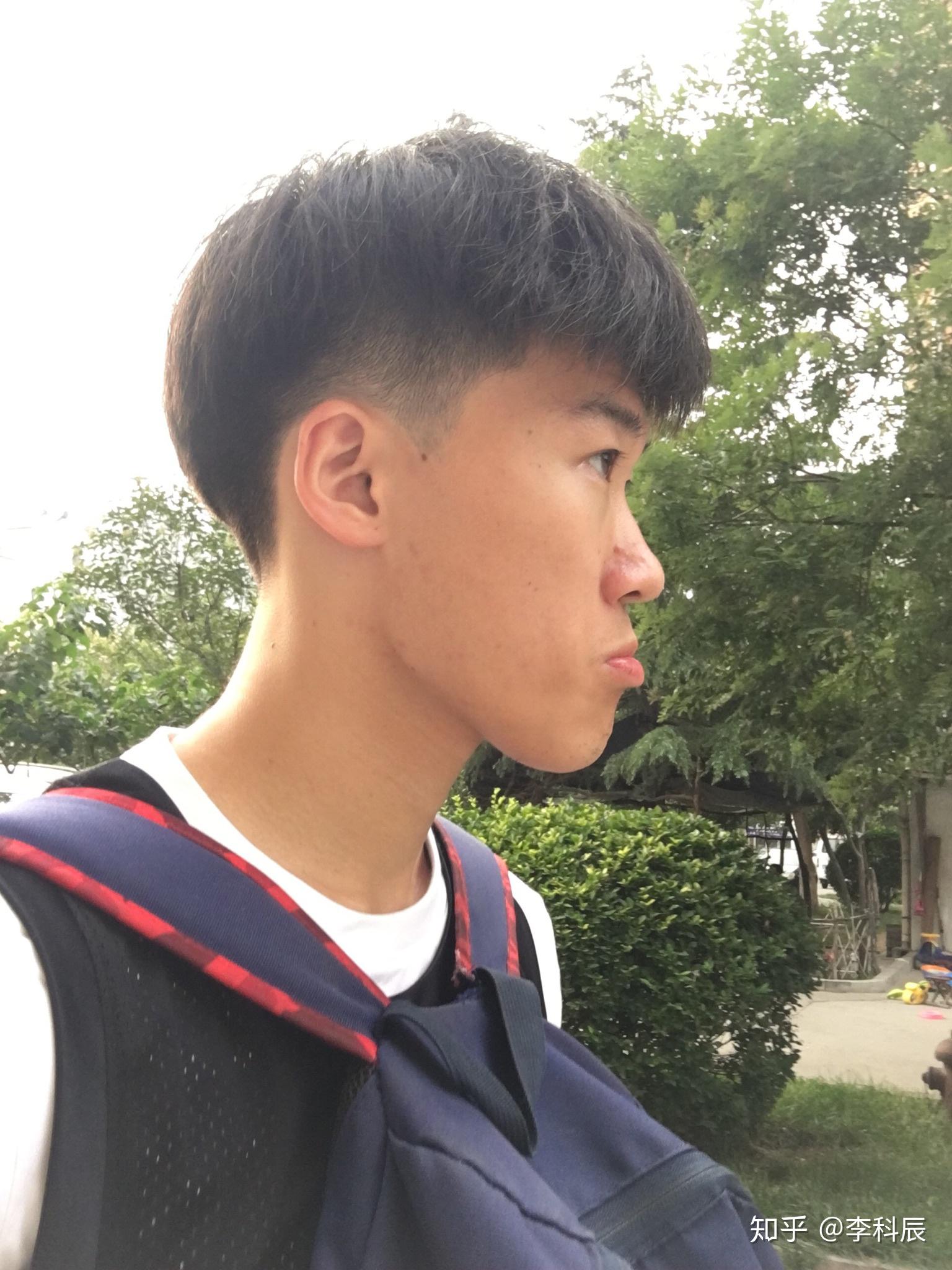 月亮脸?鞋拔子脸?是不是很丑?