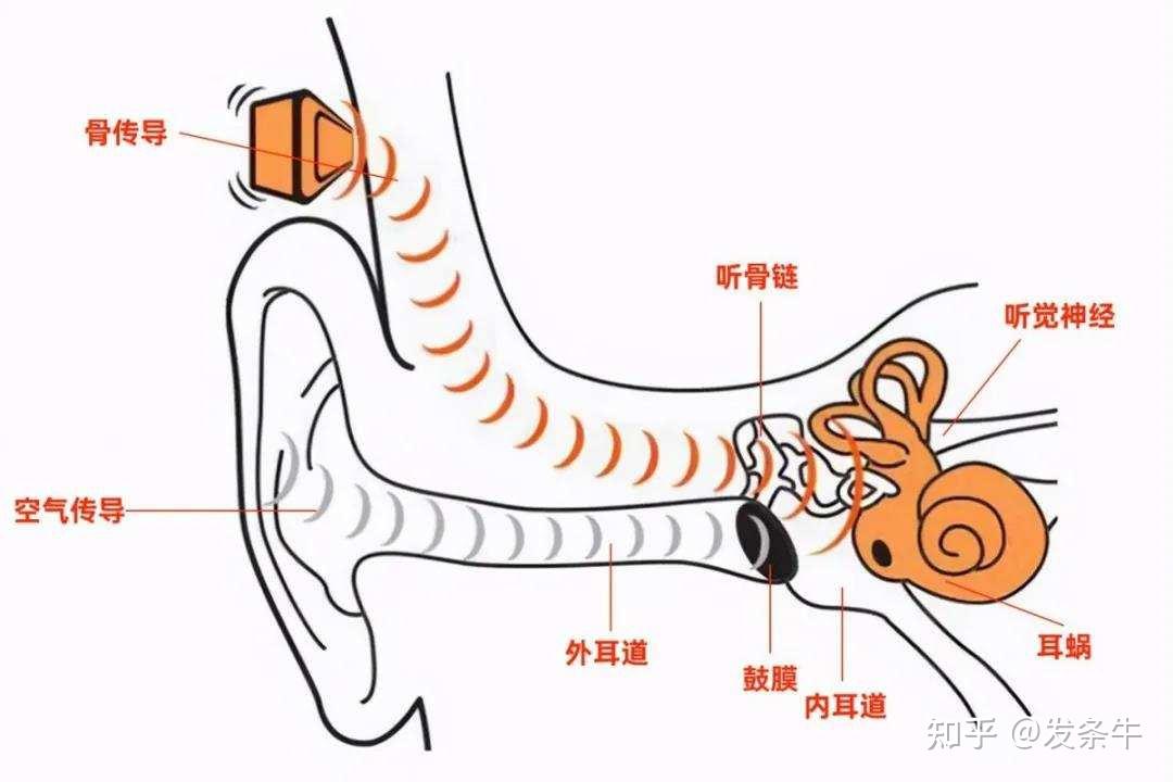 骨传导耳机结构图图片