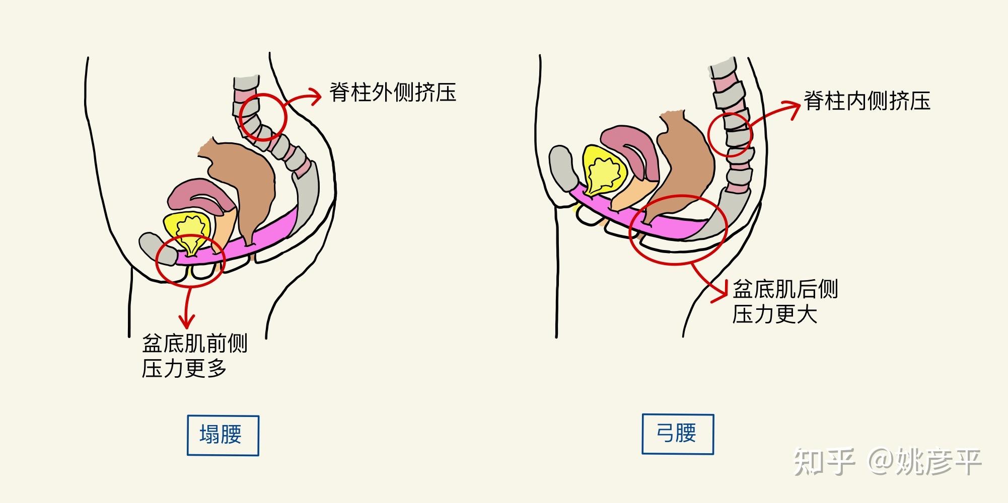 探索瑜伽理疗的秘密体式如何修复盆底肌