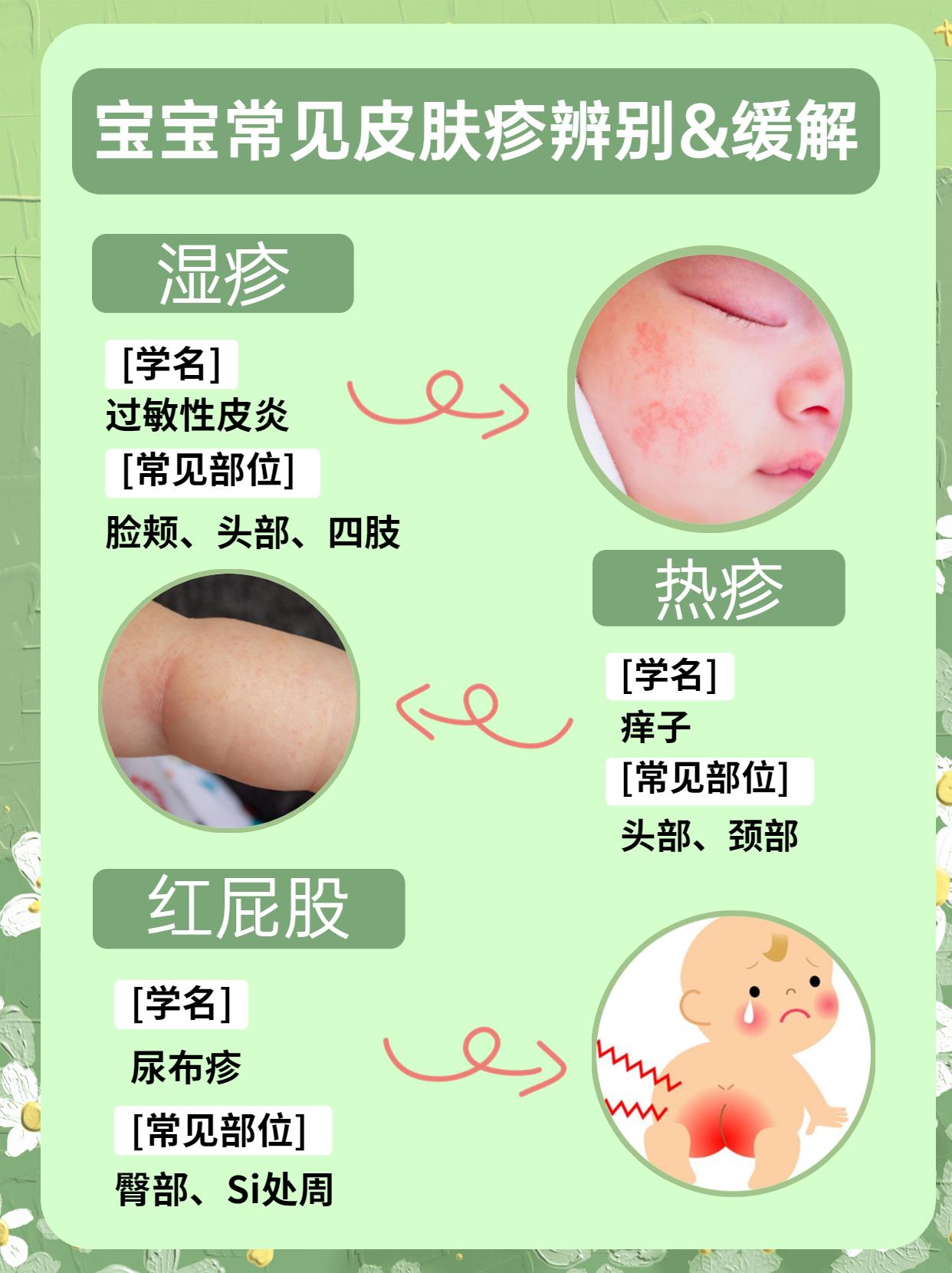 1分钟教你!辨别宝宝常见皮肤疹&缓解方法 - 知乎