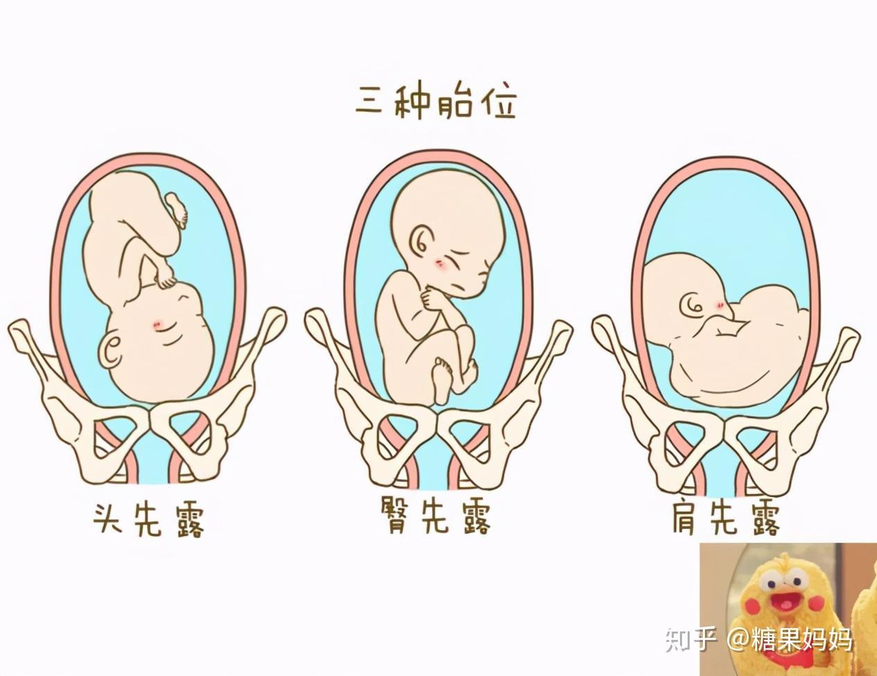 判断胎方位口诀图片