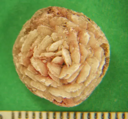 最常见的结石:鸟粪石和草酸钙结石