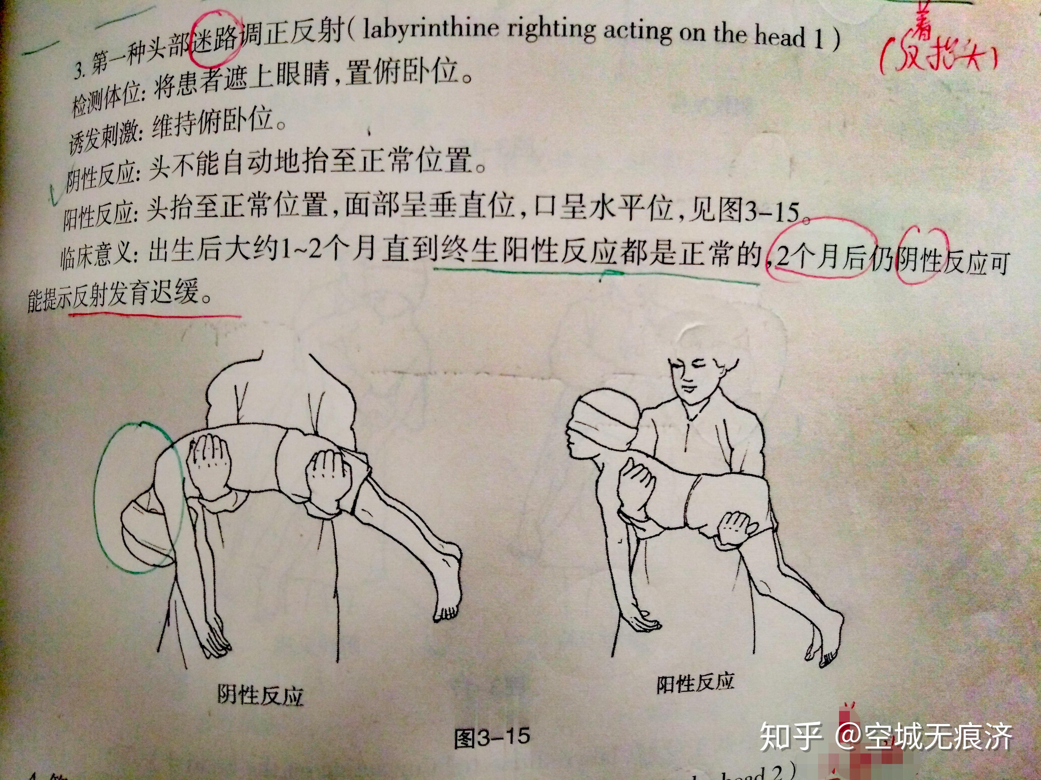 脊髓自主反射图片