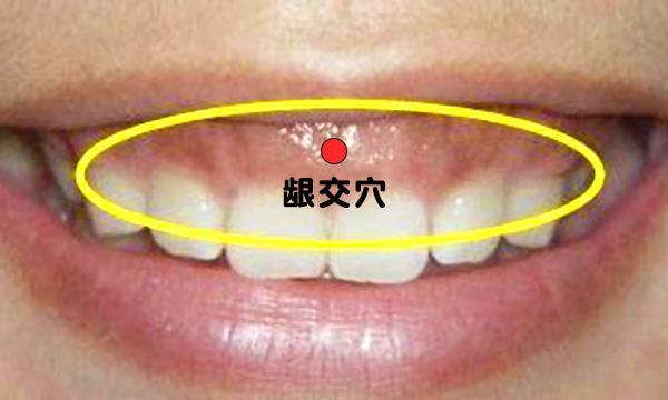 肋间神经痛是一种什么病 v2-4d6f7fee6bc2d6443727e2a525cdba76_r.jpg
