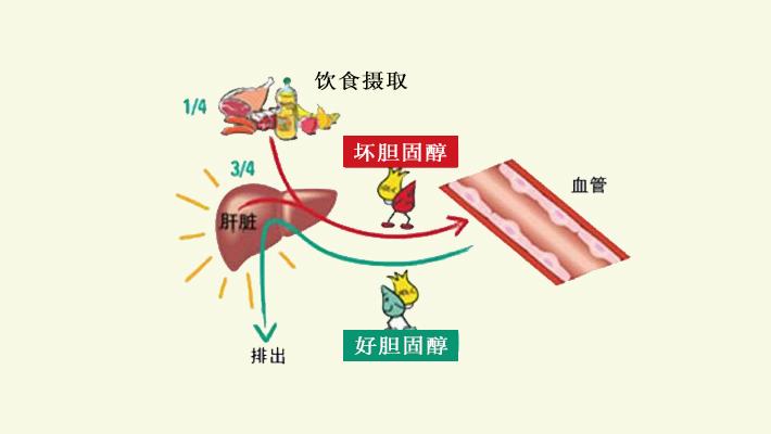手把手教你看懂血脂报告