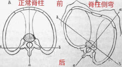 v2-4dca122b635b6dd1dc836f9d9b7f61ae_r.jpg