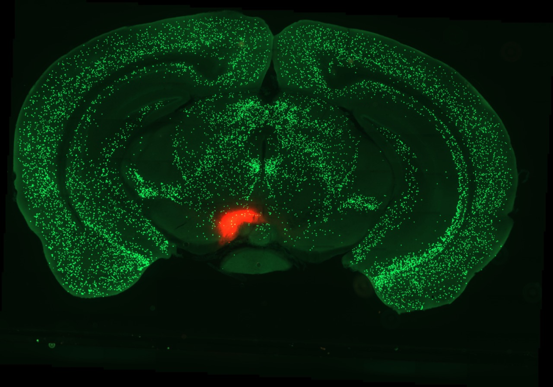 自然解密学习记忆中央杏仁核的新作用揭示了