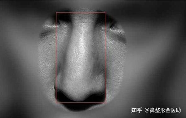了解一下常见的鼻型都有哪些? - 知乎
