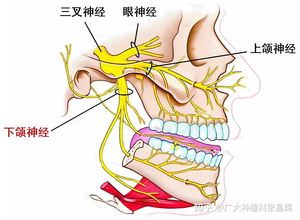 拔牙后的「危险」麻木感,要这样应对和处理#拔牙「并发症」 - 知乎