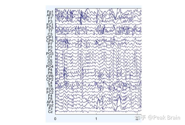 独立主成分分析（ica）应用 从脑电中去除眼电 知乎 