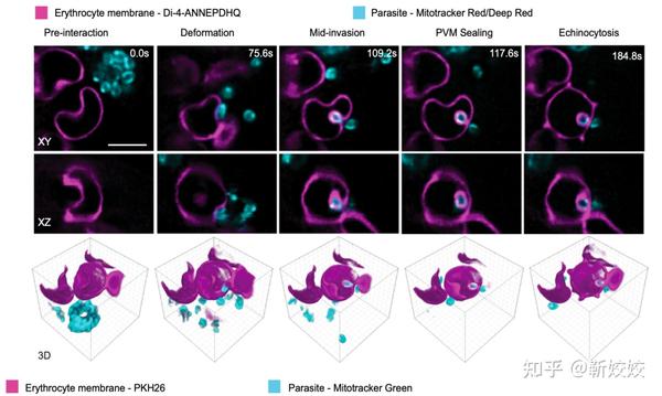 【Nat Commun】晶格光片显微镜揭示疟原虫侵染红细胞过程中膜重塑和寄生泡形成的4D动态过程 - 知乎