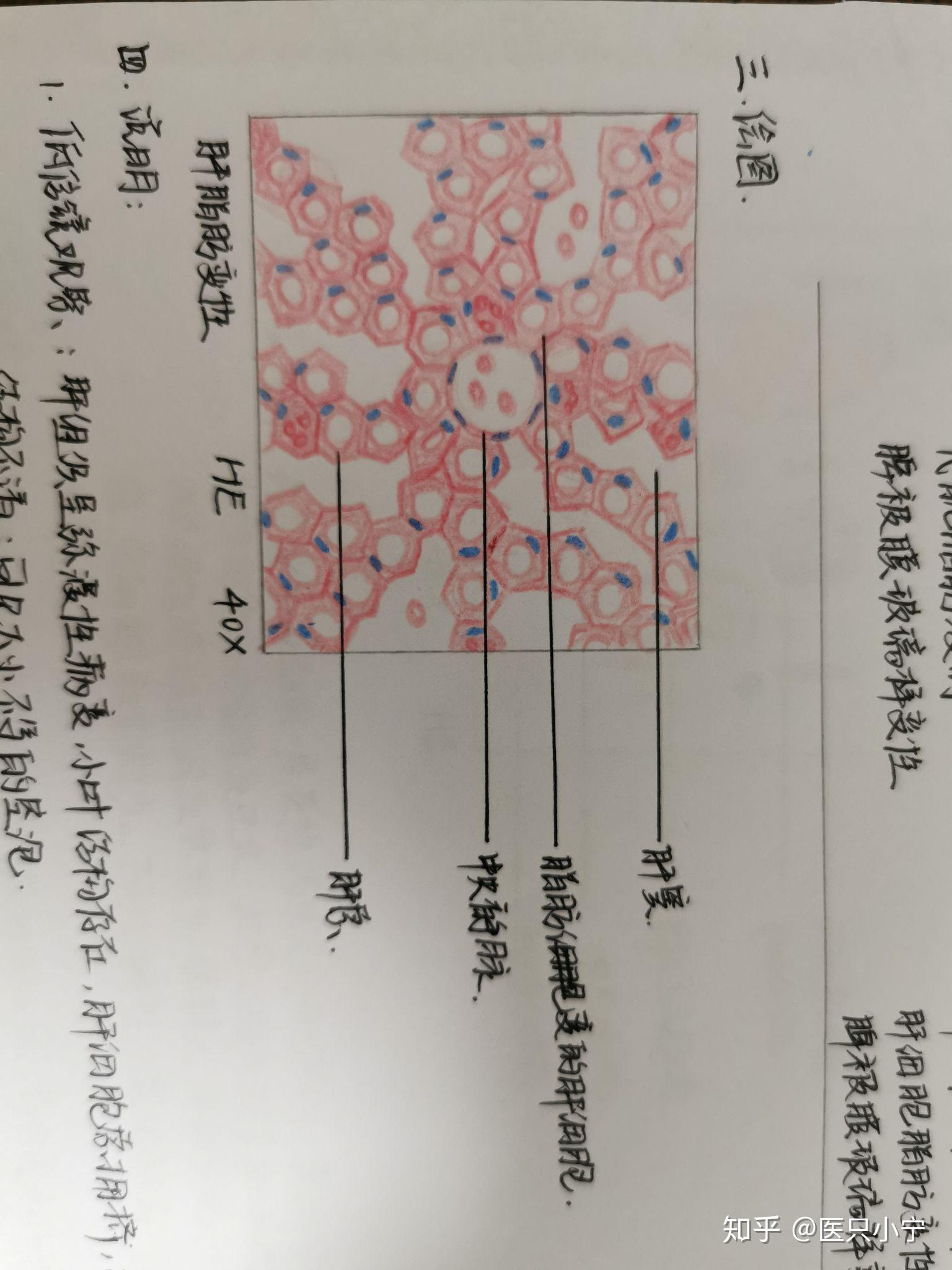 大二临床病理学红蓝铅笔图