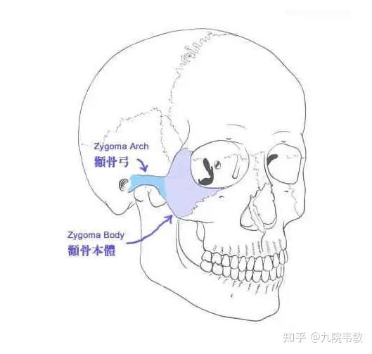 九院韦敏说,颧弓颧骨内推能让脸小多少? - 知乎