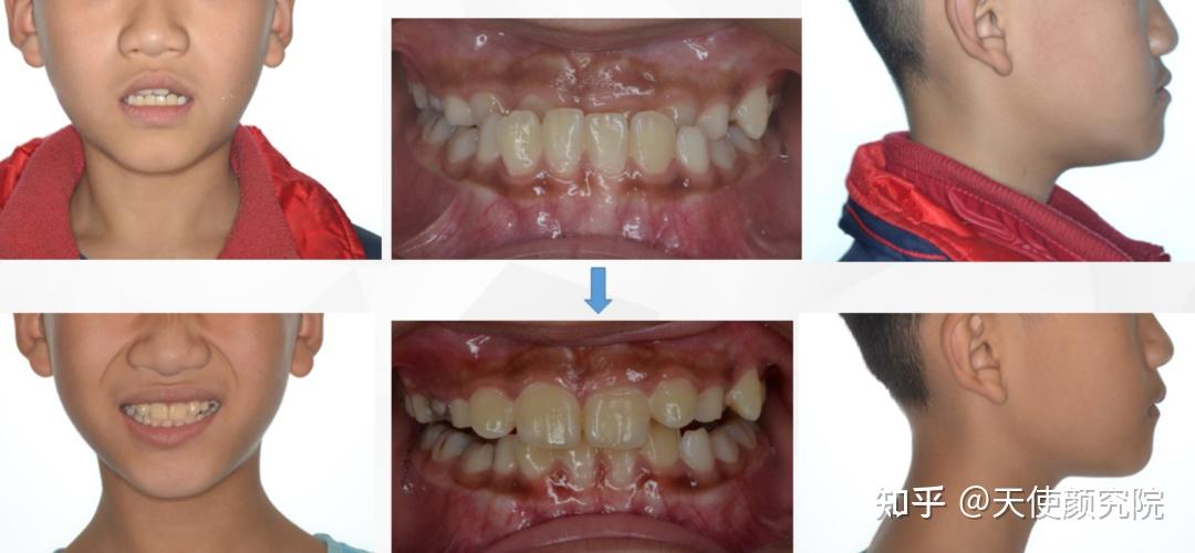 郑秀妍这段太蛊了吧!芒果台怎么能删了不播??!(郑秀妍签约英皇)