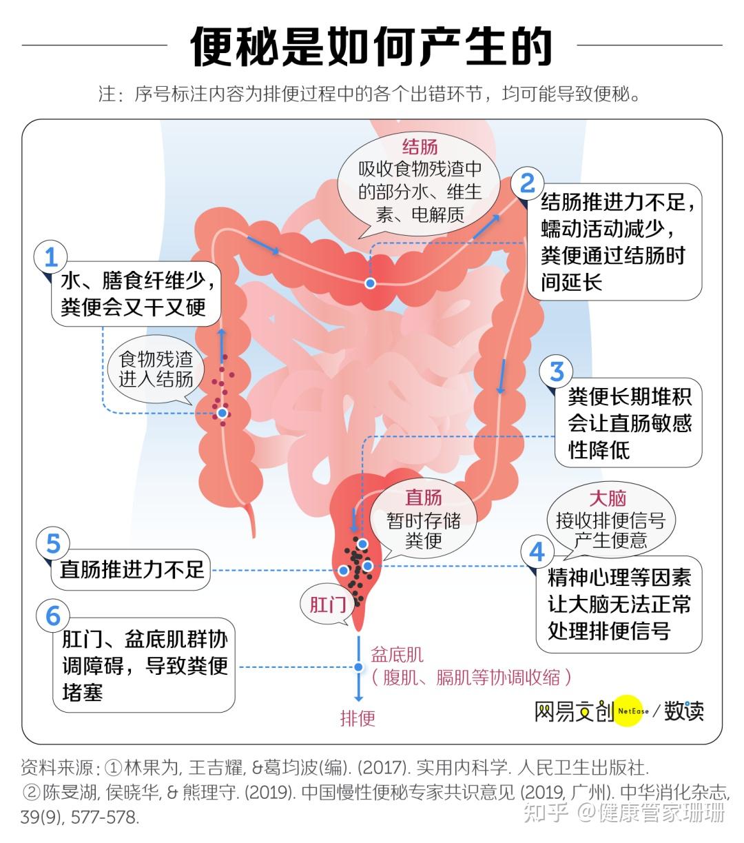 拉屎太用力,到底有多危险? - 知乎