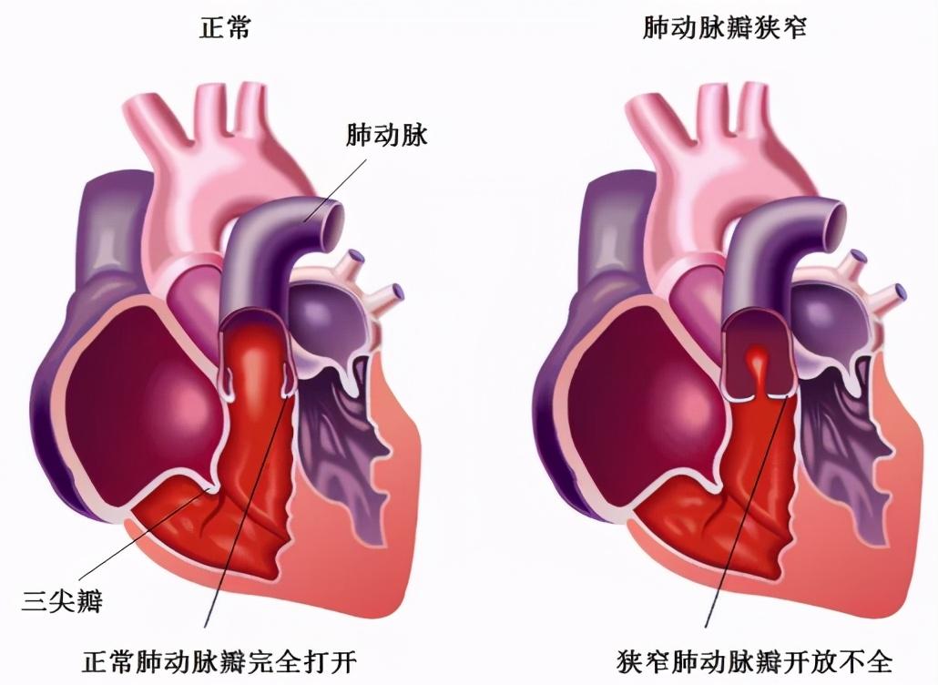 v2-4edbed3ef8a8e313eafde831ca374d4b_1440w.jpg?source=172ae18b